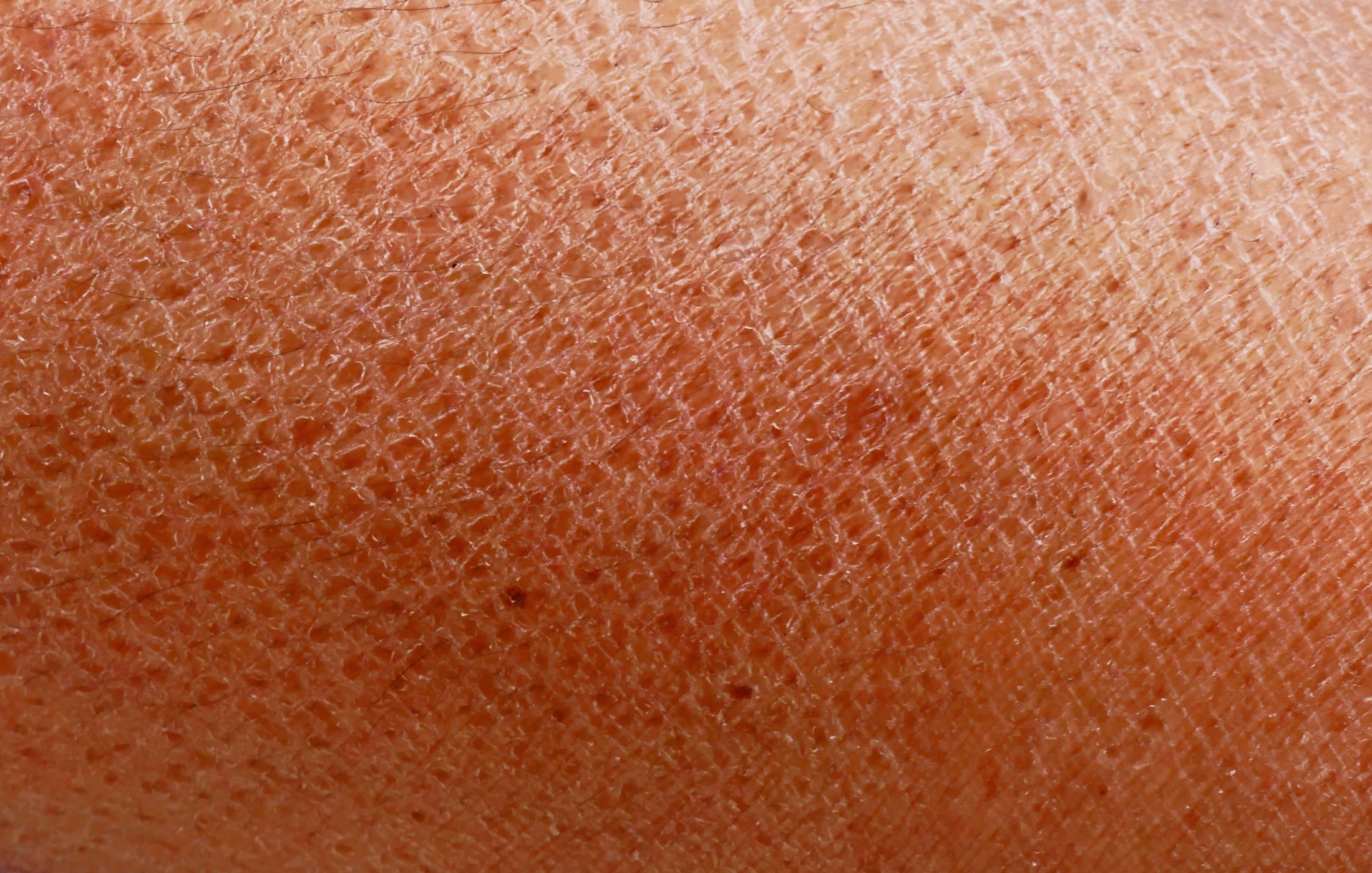 Gros plan de peau craquelée