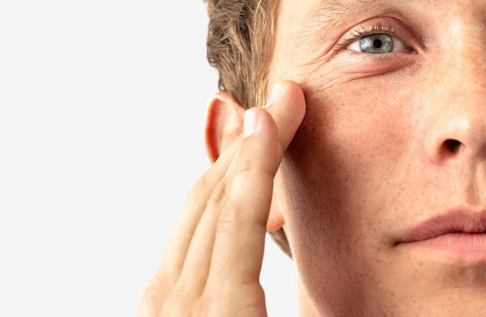 Uomo applica crema per la cura sulla guancia